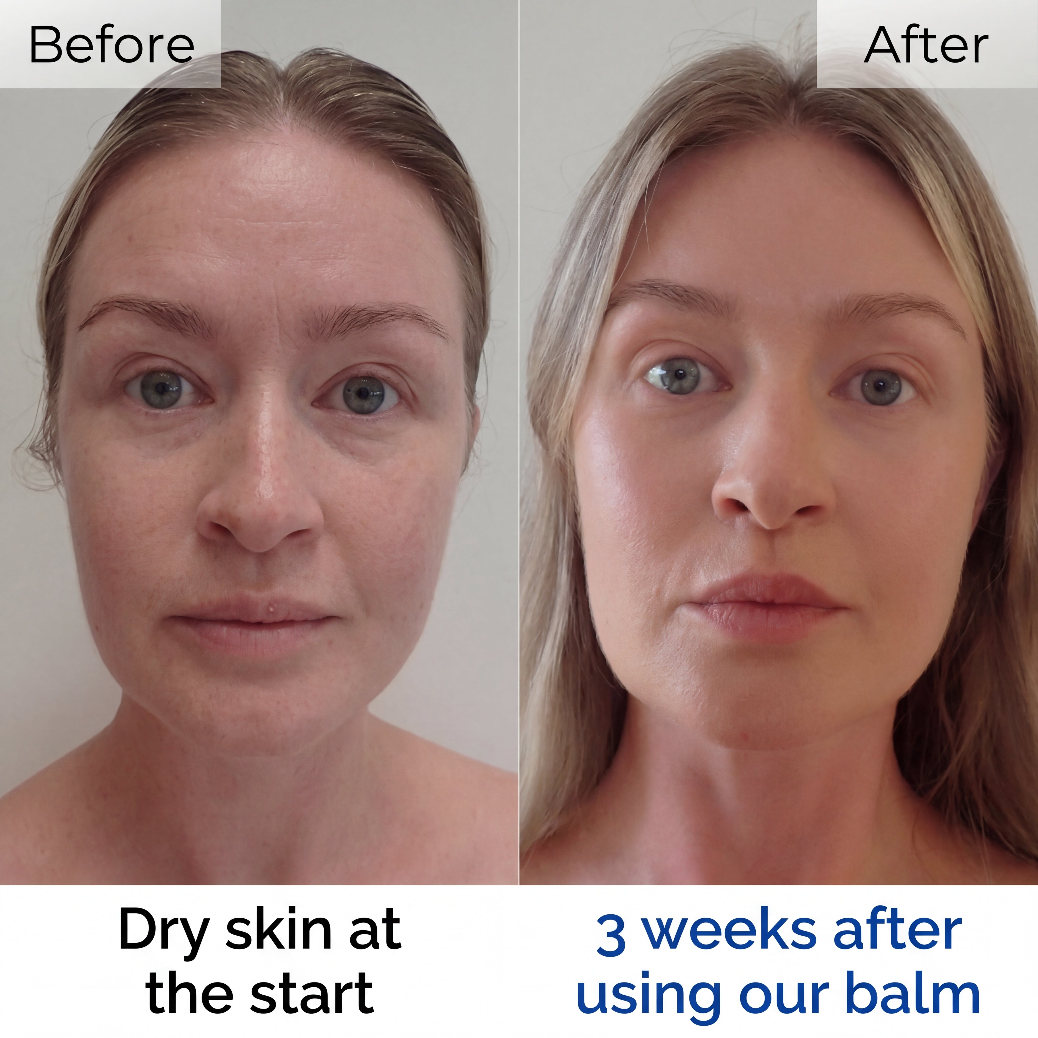 Zerane™ Whipped Tallow Honey Balm - Anti Aging Firm Skincare
